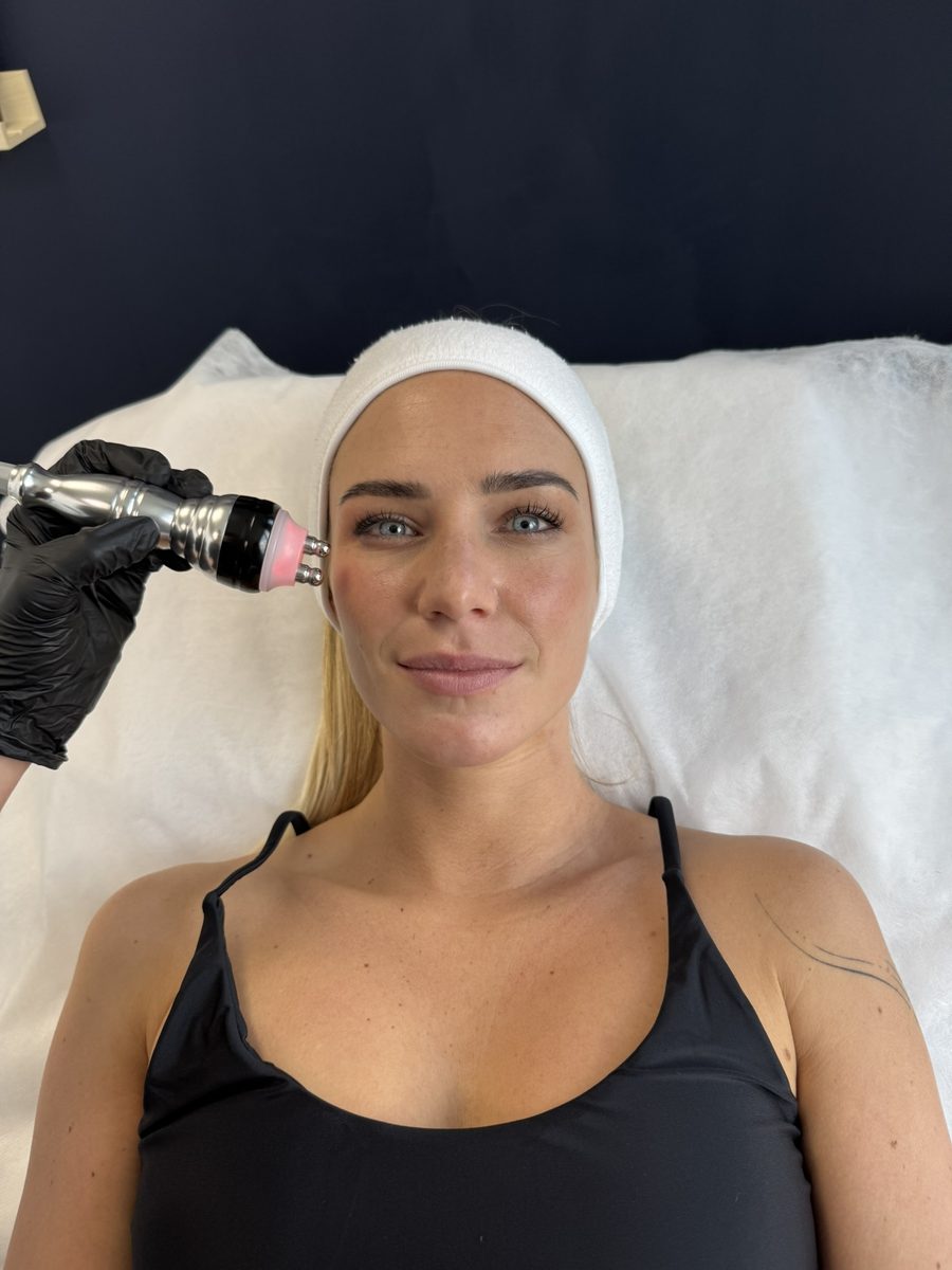 Soin du visage par radiofréquence